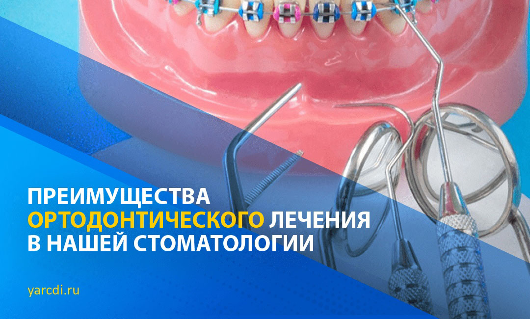Ортодонтическое лечение в клинике ЦДИ