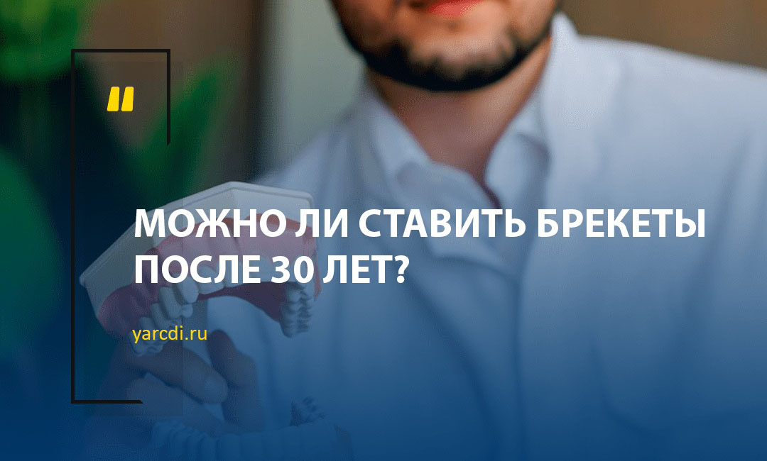 Можно ли ставить брекеты после тридцати