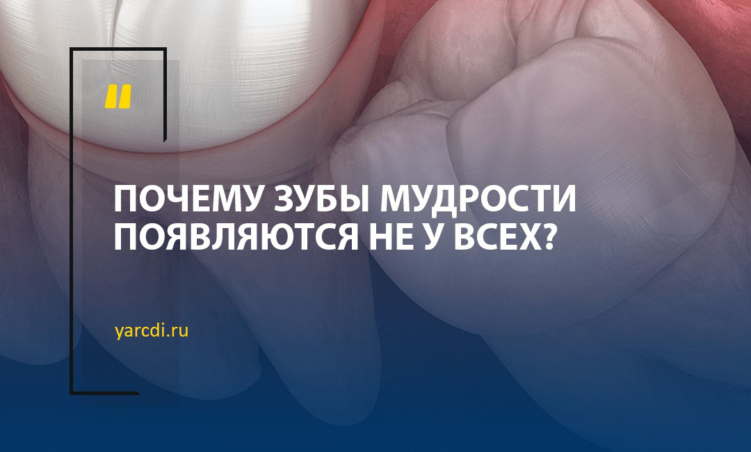 Почему зубы мудрости появляются не у всех