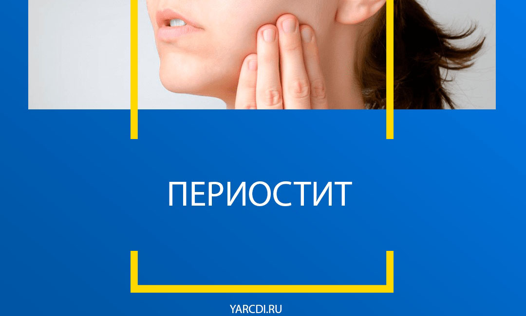 Периостит зуба. В народе просто — флюс