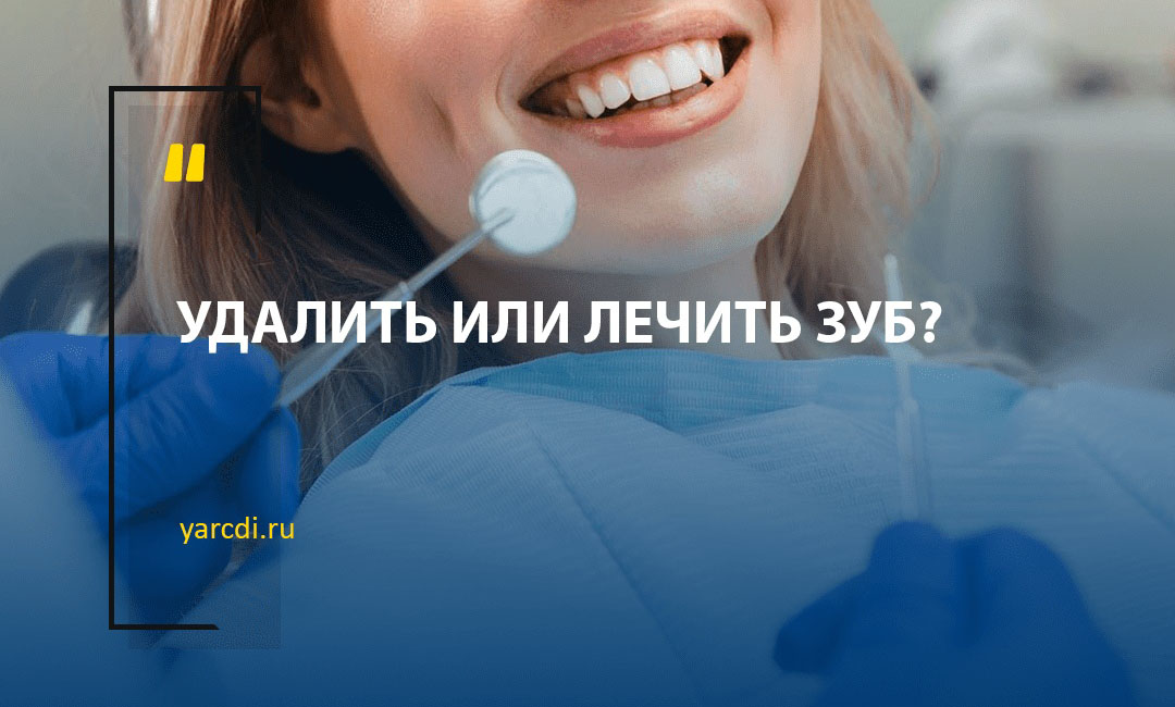 Сохранить больной зуб или удалить его